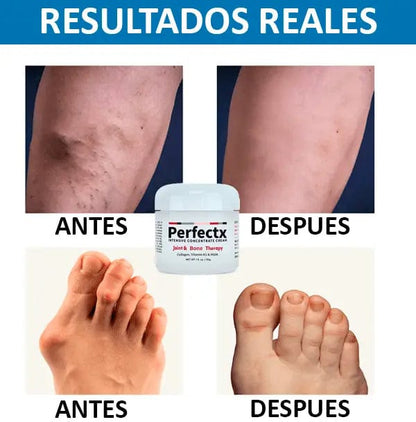 Terapia Articular - Crema Perfectx™🔥